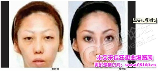 整容儿子丑丈夫离婚：女子整容生个儿子很丑！