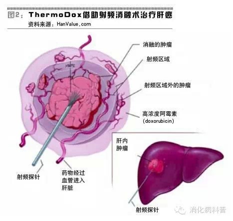 2015中国肿瘤登记年报，综合防治肿瘤的措施！