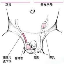 乐嘉睾丸破碎还好用吗？睾丸损伤会造成什么影响？