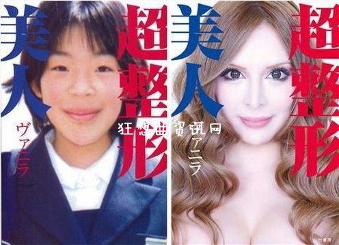 整容机器美人：女子整容30多次变身美女(图)