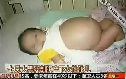 孕妇遭雷劈后生下女婴，盘点那些生孩子的奇葩怪事！