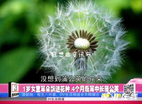 摘花手术：婴儿耳中长出蒲公英 医生手术“摘花”(图)