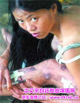 女人患艾滋病症状图片，女性艾滋病感染者图片