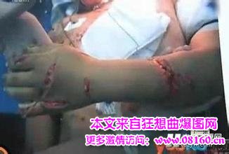 女子醉驾被查当众脱裤与民警厮打，新婚女子被丈夫砍图