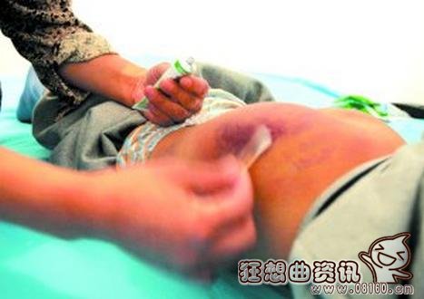 男童遭老师4次毒打，8岁男童被疑偷校长手表