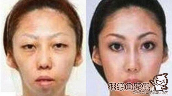 丈夫因妻子整容离婚，最终和平离婚